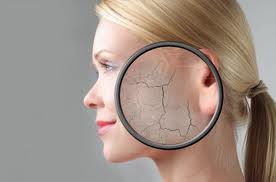 Buy Dermex Capsules